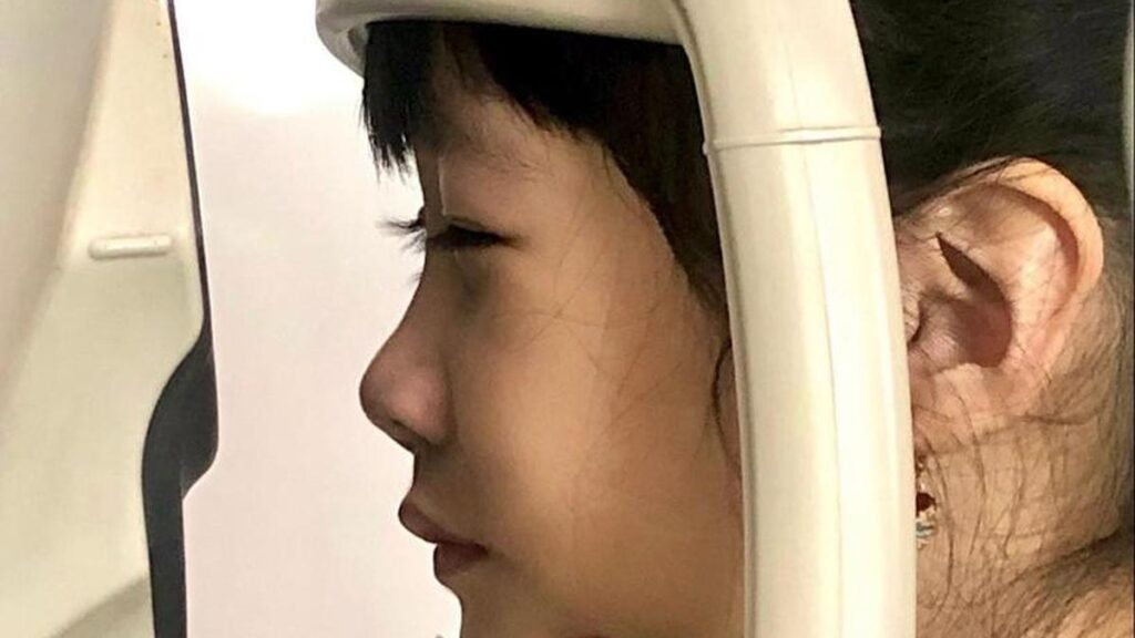 Anak-anak dan Kecanduan Gadget: Lonjakan Rabun Jauh yang Mengkhawatirkan